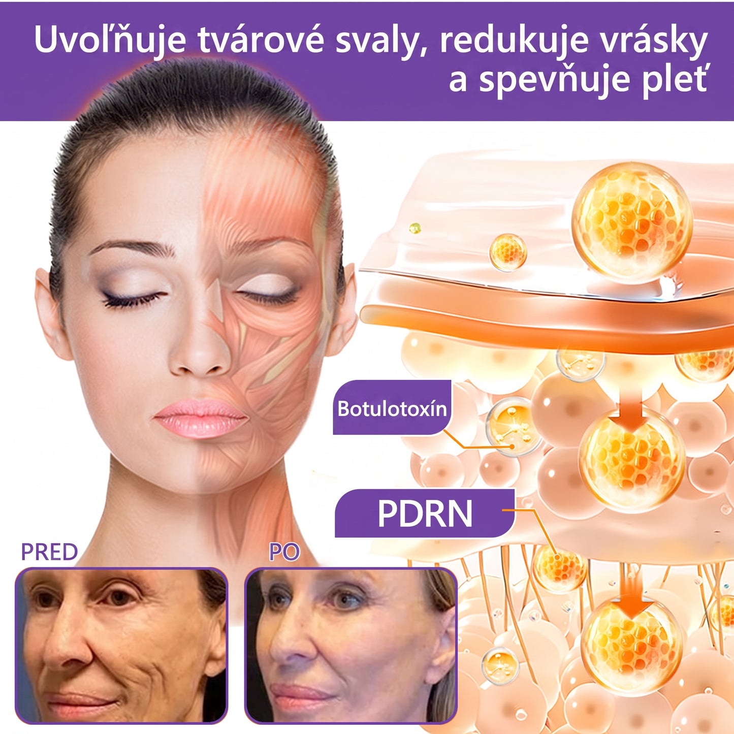 🇸🇰 Odporúčané dermatológmi🥇 | 🍍Vitalisys® PDRN multipeptidový masážny telový krém – Proti starnutiu, hydratačný, spevňujúci, regeneračný, zjednocujúci, na odstraňovanie akné a škvŕn, odstraňovanie bradavíc a materských znamienok, zmiernenie psoriázy.❤️