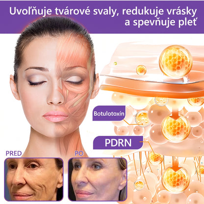 🇸🇰 Odporúčané dermatológmi🥇 | 🍍Vitalisys® PDRN multipeptidový masážny telový krém – Proti starnutiu, hydratačný, spevňujúci, regeneračný, zjednocujúci, na odstraňovanie akné a škvŕn, odstraňovanie bradavíc a materských znamienok, zmiernenie psoriázy.❤️