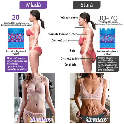 🇸🇰 Odporúčané dermatológmi🥇 | 🍍Vitalisys® PDRN multipeptidový masážny telový krém – Proti starnutiu, hydratačný, spevňujúci, regeneračný, zjednocujúci, na odstraňovanie akné a škvŕn, odstraňovanie bradavíc a materských znamienok, zmiernenie psoriázy.❤️