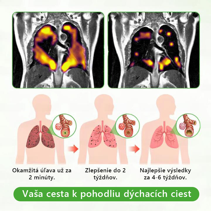 🇸🇰 Slovenské vlastníctvo a správa ✅ Murwon® bylinný difuzér na čistenie pľúc s divozelom (Mullein) 🫁 (kašeľ, faryngitída, dýchavičnosť, hlieny, upchatý nos, bronchitída, alergické príznaky, nepohodlie v pľúcach) 🌹