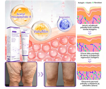 🇸🇰 Odporúčané dermatológmi🥇 | 🍍Vitalisys® PDRN multipeptidový masážny telový krém – Proti starnutiu, hydratačný, spevňujúci, regeneračný, zjednocujúci, na odstraňovanie akné a škvŕn, odstraňovanie bradavíc a materských znamienok, zmiernenie psoriázy.❤️