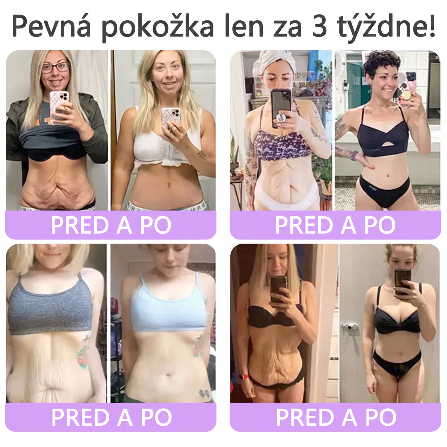 🇸🇰 Odporúčané dermatológmi🥇 | 🍍Vitalisys® PDRN multipeptidový masážny telový krém – Proti starnutiu, hydratačný, spevňujúci, regeneračný, zjednocujúci, na odstraňovanie akné a škvŕn, odstraňovanie bradavíc a materských znamienok, zmiernenie psoriázy.❤️