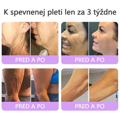 🇸🇰 Odporúčané dermatológmi🥇 | 🍍Vitalisys® PDRN multipeptidový masážny telový krém – Proti starnutiu, hydratačný, spevňujúci, regeneračný, zjednocujúci, na odstraňovanie akné a škvŕn, odstraňovanie bradavíc a materských znamienok, zmiernenie psoriázy.❤️