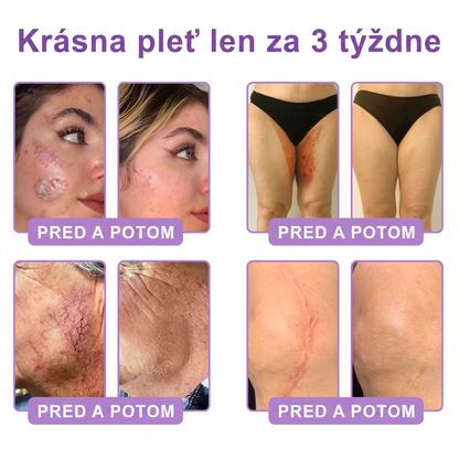 🇸🇰 Odporúčané dermatológmi🥇 | 🍍Vitalisys® PDRN multipeptidový masážny telový krém – Proti starnutiu, hydratačný, spevňujúci, regeneračný, zjednocujúci, na odstraňovanie akné a škvŕn, odstraňovanie bradavíc a materských znamienok, zmiernenie psoriázy.❤️
