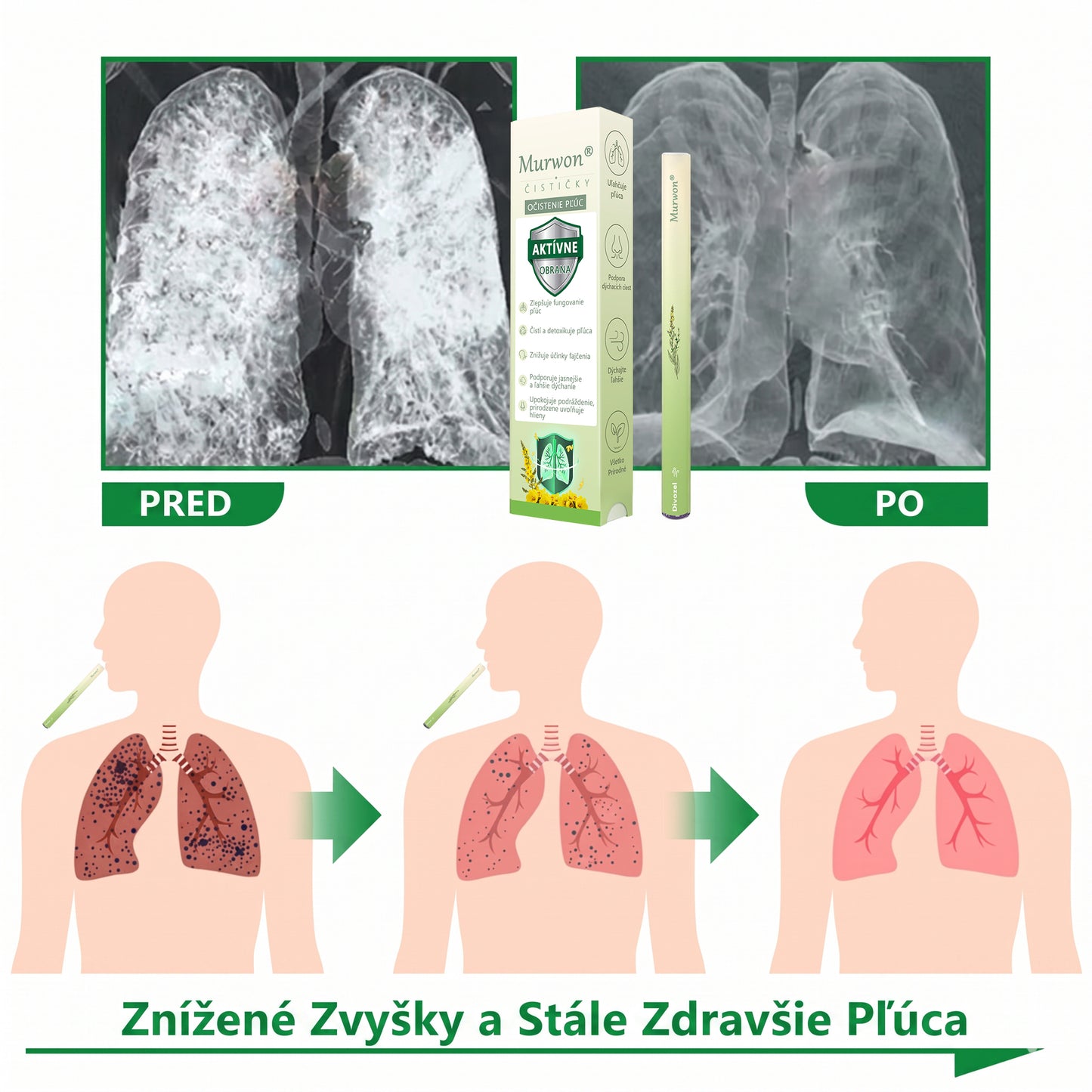 🇸🇰 Vysoko kvalitný slovenský výrobok s doručením v rámci krajiny 🥇 Murwon® bylinný inhalátor na čistenie pľúc 🍐 (👨‍⚕️ Účinná pomoc: kašeľ, zápal hrtana, krátenie dychu, hlieny, ucpaný nos, bronchitída, alergické príznaky a pľúcne ťažkosti) ❤️