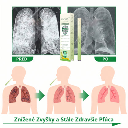 🇸🇰 Vysoko kvalitný slovenský výrobok s doručením v rámci krajiny 🥇 Murwon® bylinný inhalátor na čistenie pľúc 🍐 (👨‍⚕️ Účinná pomoc: kašeľ, zápal hrtana, krátenie dychu, hlieny, ucpaný nos, bronchitída, alergické príznaky a pľúcne ťažkosti) ❤️
